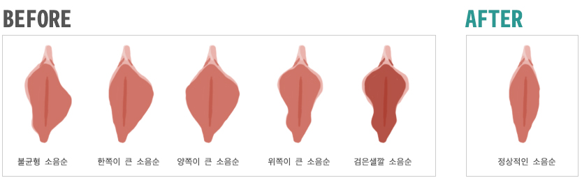 ������ before & after